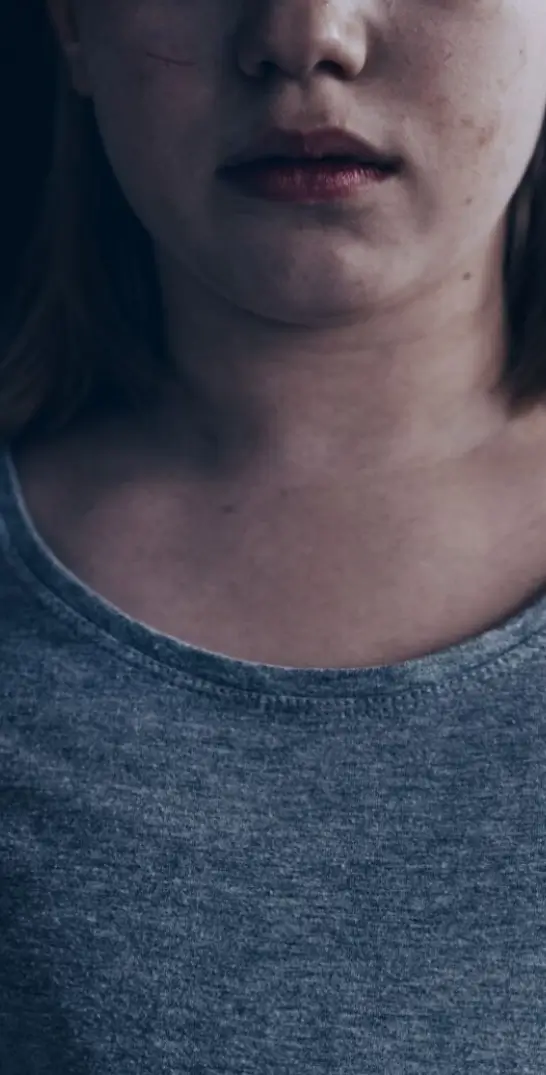 Image on an child who is assaulted or spank